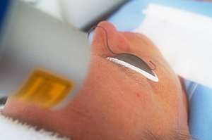 Kaltlaser-Therapie gegen Falten Kaltlaser-Therapie gegen Falten